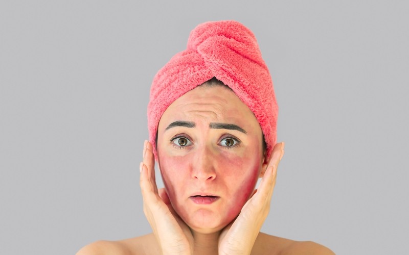 hydroquinone-gay-kich-ung thư da