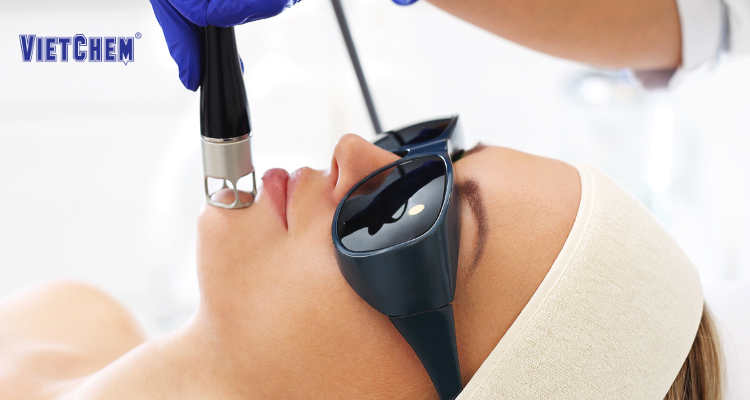 kinh nghiệm-bao-ho-chong-ray-laser