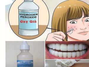 Dung dịch H2O2 được dùng làm chất khử trùng, diệt khuẩn