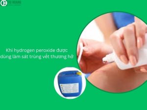 Khi sử dụng hydrogen peroxide để khử trùng vết thương hở
