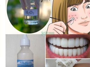 Ứng dụng Hydrogen Peroxide trong lĩnh vực y tế