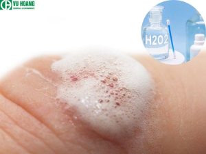 Dùng hydrogen peroxide để làm sạch vết thương khiến người bệnh cảm thấy đau đớn