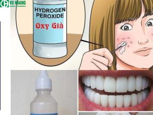 Hydrogen Peroxide trong lĩnh vực y tế