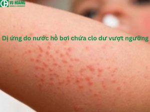 Dị ứng do nước sinh hoạt chứa quá nhiều clo 