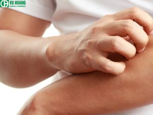 Thuốc tím dùng chữa viêm da